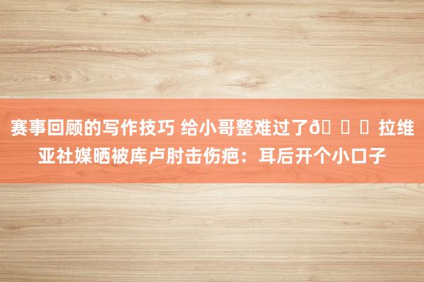 赛事回顾的写作技巧 给小哥整难过了😅拉维亚社媒晒被库卢肘击伤疤：耳后开个小口子